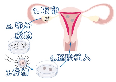 李雪梅